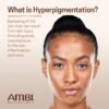 81dW0jtvjwL._SL1500_.jpg Ambi Even & Clear Advanced Fade Cream, Hydroquinone-free, Hyperpigmentation Treatment, Stubborn Dark Spot Corrector, Results In As Little As 2-3 Weeks, Niacinamide, Licorice Root Extract, PHA, 1 Fl Oz