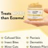 ECZEMA HONEY Original Skin-Soothing Cream - Organic Hand & Body Eczema Relief - Natural Honey Lotion for Dry, Itchy, & Irritable Skin (4 Oz)