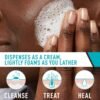 81jV8hZEadL._SL1500_.jpg CeraVe Acne Foaming Cream Cleanser, 4% Benzoyl Peroxide Face Wash With Hyaluronic Acid, Niacinamide & Ceramides, Gentle Daily Acne Treatment For Face