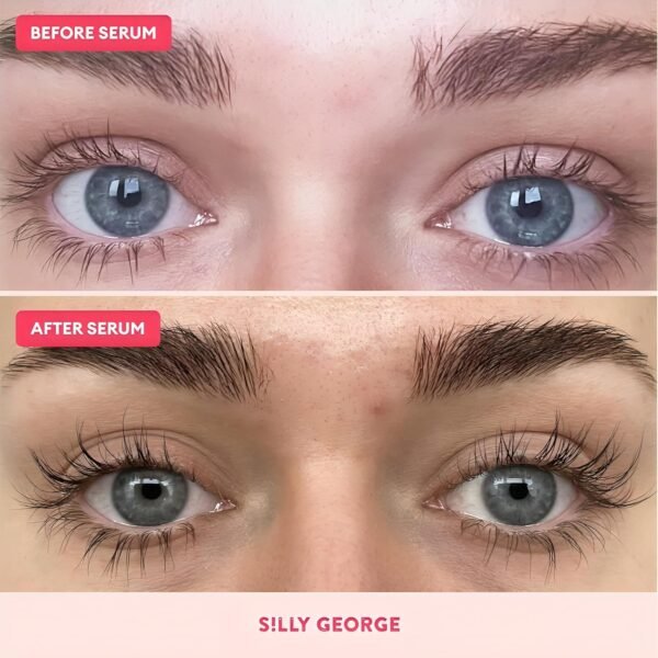 81kE3PsOQnL._SL1500_.jpg Silly George Eyelash Growth Serum for Thicker, Fuller, Longer & Bold Eyebrows, Premium Serum, Lashes & Brows Enhancer, (3ml, 0.1 Fl. oz)