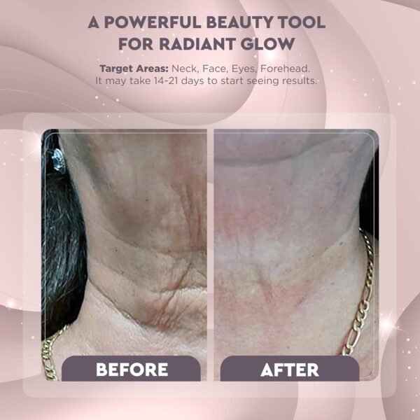 GLO24K Red Light Beauty Device for Face and Neck - Based on Triple Action LED, Thermal, and Vibration Technologies