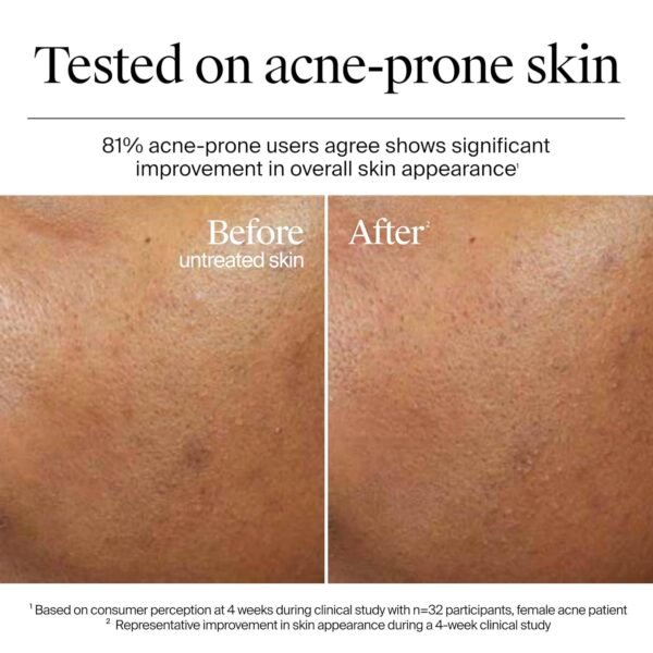 Neutrogena Hydro Boost Skincare Set, Hydro Boost Fragrance Free Gel Cream Face Moisturizer, 1.7 fl oz, & Trial Size Hydro Boost Fragrance Free Hydrating Gel Facial Cleanser, 0.5 fl oz