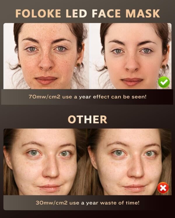 FOLOKE LED Light Therapy Mask Skin Care Mask, LED Red Light Therapy 630nm & 830nm Wavelength for Home Use, Body Beauty Machine for Care at Home (luxurious black)