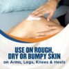 81zJi5BFmLL._SL1500_.jpg Gold Bond Rough & Bumpy Daily Skin Therapy Cream, 8 oz., With 7 Moisturizers & 3 Vitamins