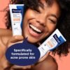 91OiogLxbFL._SL1500_.jpg PanOxyl PM Balancing Repair Moisturizer with Niacinamide, Ceramides and Cica, Hydrating Face Moisturizer, Acne Prone Skin and Dry Skin, Non-Comedogenic Night Face Moisturizer, 3 oz