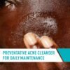 91UWF6ocPpL._SL1500_.jpg CeraVe Acne Treatment Face Wash, Salicylic Acid Cleanser with Purifying Clay, Niacinamide, and Ceramides, Pore Control and Blackhead Remover, 8 Ounce