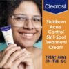 Clearasil Stubborn Acne Control 5in1 Spot Treatment Cream, 1 oz