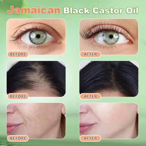 1753021996_71wsjdpjmkL._SL1500_.jpg Jamaican Black Castor Oil Cold Pressed,Castor Oil in A Glass Bottle with Glass Dropper, Eyelash&Eyebrow Brushes,Hexane Free for Fuller Thicker Hair, Eyelashes,Moisturizes Skin