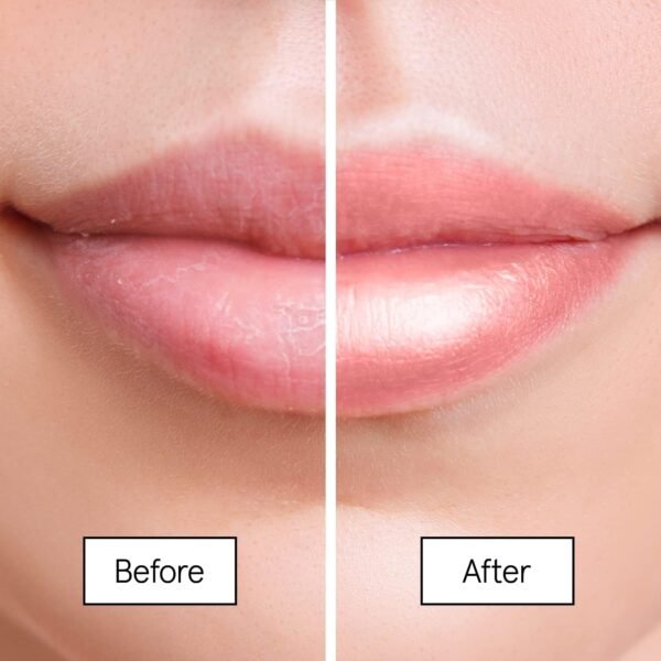 61nm0rJYbL._SL1500_.jpg Grace & Stella Award Winning Lip Plumper Nourishing Berry Lip Mask - Lip Balm Hydrating - Lip Moisturizer For Very Dry Lips - Overnight Lip Mask & Lip Treatment & Lip Sleeping Mask - Vegan