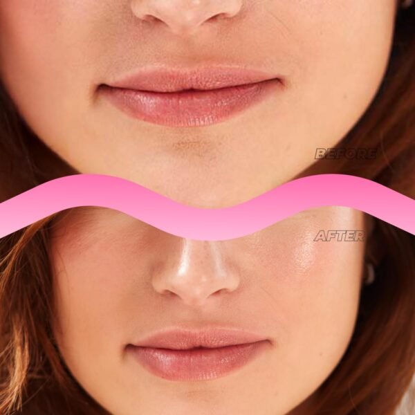 613YIUs0oL._SL1200_.jpg Instant Lip Filler for Plumped Lips in 30 Mins by Vitamasques, 3 Pack - Korean Skin Care Vegan Collagen, Hyaluronic Acid & 400 Dissolving Micro-Dart Tech for Instant & Long-Lasting Results
