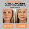 61N7wRf3fXL._SL1080_.jpg Retinol + Collagen, Hyaluronic Acid, Vitamin C Anti-Aging Face Cream, Day and Night Moisturizing Cream, Anti-Wrinkle Cream for Face, Firming Cream - 4oz
