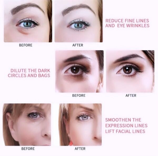 1500 Vitamin A Retinol Cream Anti-Ageing Anti-Wrinkle Cream for Dehydrated Skin 30g / 1.06 Oz