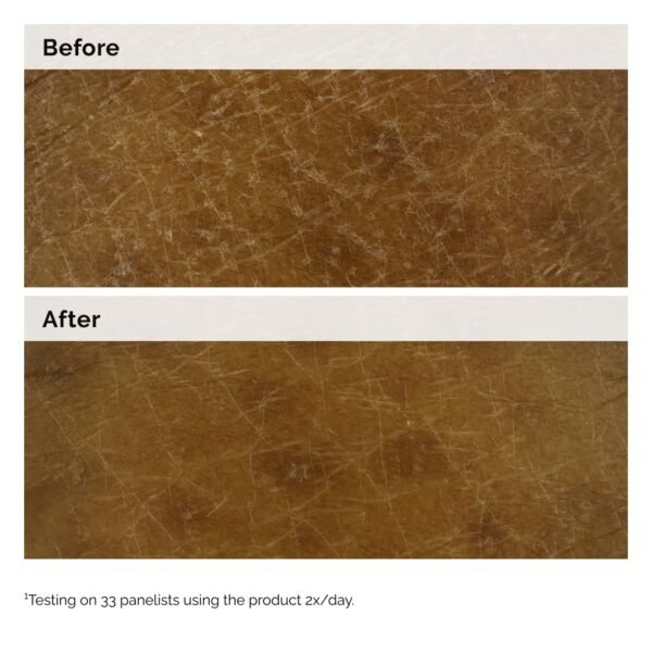 The Ordinary Natural Moisturizing Factors + Inulin Body Lotion, Lightweight Hydration for All-Day Moisture & Skin Barrier Support, 8.1 Fl Oz