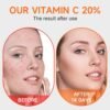 Vitamin c face serum with hyaluronic acid and vitamin e,Skin care, Anti ageing,Anti wrinkles, Smoother and Plumper Skin beauty products 1.35 fl oz