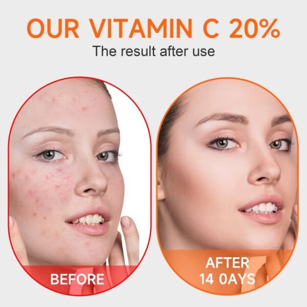 Vitamin c face serum with hyaluronic acid and vitamin e,Skin care, Anti ageing,Anti wrinkles, Smoother and Plumper Skin beauty products 1.35 fl oz