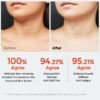 61icjGqKNkL._AC_SL1200_.jpg Neck & Décolleté Firming Beauty Device – LED Light Therapy Skin Tone and Texture Enhancement, 630nm and 830nm Dual Wavelengths Emission LED Device, Liquid Silicone