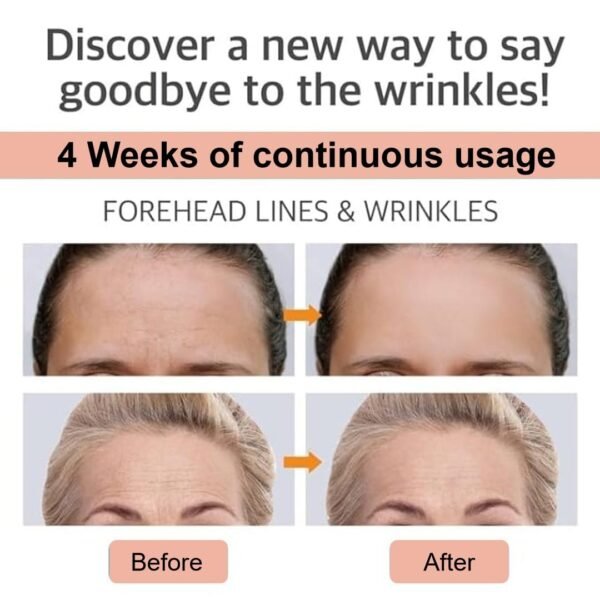 61t4LNznpaL._SL1080_.jpg Forehead Wrinkle Patches, Anti Wrinkle Facial Patches for Face Overnight to Reduce Frown Lines, Reusable Anti-Ageing Forehead Wrinkle Treatment for Women 6 pcs