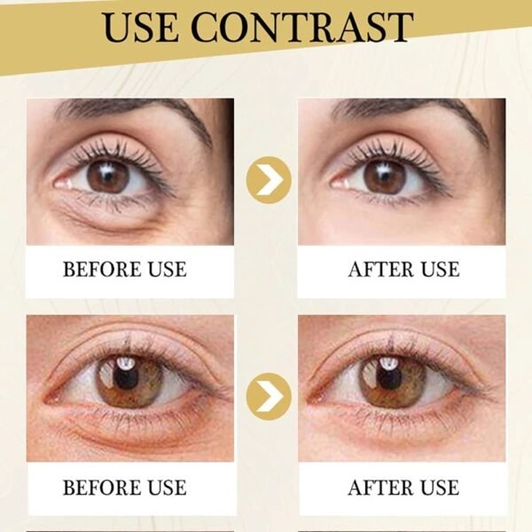 Polypeptide Eye Cream Anti-Aging Wrinkie Removal Dark Circles Remove Eye Bags Nourishing Eye Serum Skin Care