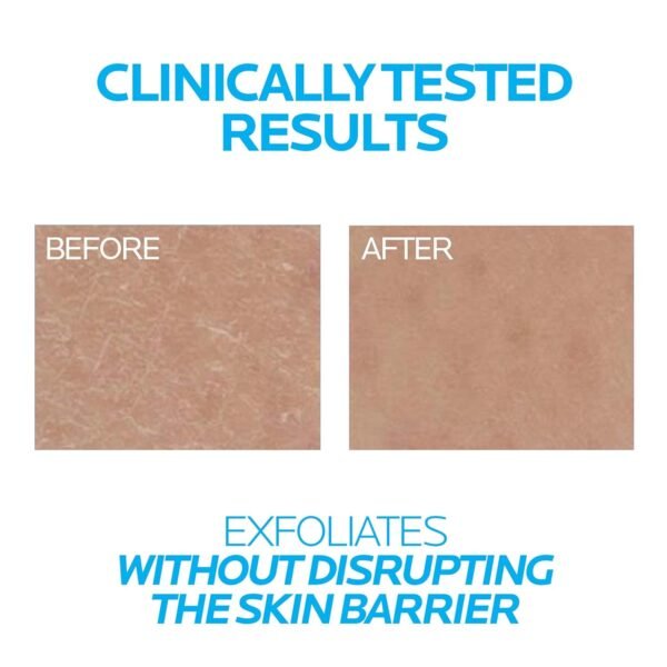 710iS9pa6L._SL1500_.jpg La Roche-Posay Lipikar Urea 10% Roughness Smoothing Lotion, Body Lotion For Dry Skin With 10% Urea + Shea Butter + Allantoin, Rough And Bumpy Skin Lotion, Softens & Smooths Skin With 1 Application