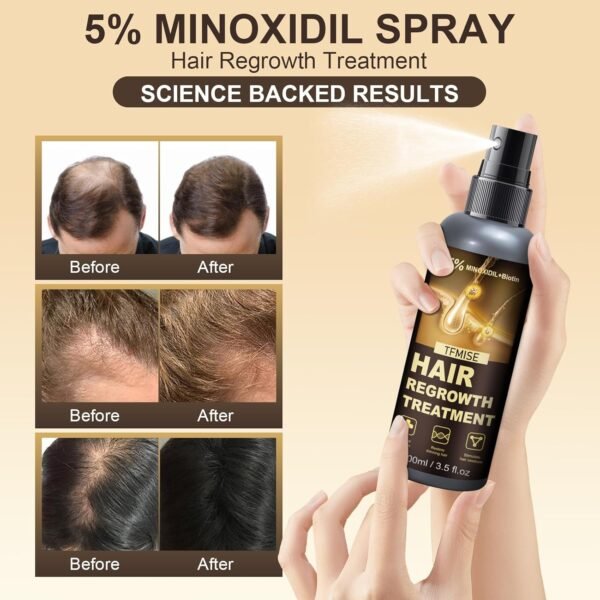5% Minoxidil for Men, 100ml x 2 Pack Minoxidil for Women Hair Growth, Minoxidil Spray Hair Growth Products Kit, Hair Growth Serum with Biotin, Hair Regrowth Treatment for Light and no Greasy