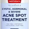 711xtHilVL._SL1500_.jpg Warrior One (0.5oz) Acne Spot Treatment with 2% Salicylic Acid, Cystic and Hormonal Acne Cream, Acido Salicilico Acne Spot Treatment for Face, acne Cream for Adults and Teens, 150+ Uses