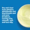 714Z7XAl6IL._SL1500_.jpg De La Cruz Sulfur Ointment - Cystic Acne Treatment for Face and Body - Daily 10 Min Spot Treatment Mask - Safe and Effective Game Changing Hormonal Acne Treatment That Clears Up Pimples 5.5 OZ.