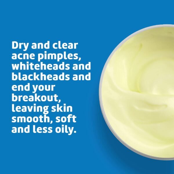 714Z7XAl6IL._SL1500_.jpg De La Cruz Sulfur Ointment - Cystic Acne Treatment for Face and Body - Daily 10 Min Spot Treatment Mask - Safe and Effective Game Changing Hormonal Acne Treatment That Clears Up Pimples 5.5 OZ.