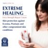 Extreme Healing, Non-Sticky, Fast-Absorbing Lotion For Dry Skin with Eczema and Psoriasis, Fragrance Free Lotion with Patented Ingredient SBD-4, Soothing Relief for Hand and Body, 3 Oz