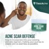 TreeActiv Acne Scar Treatment, 2 fl oz, Acne Scar Cream for Face, Gentle Acne Scars and Dark Spot Remover, Scar Lotion for Stretch Marks and Body Scars, Acne Scar Removal for All Skin Types, 500+ Uses