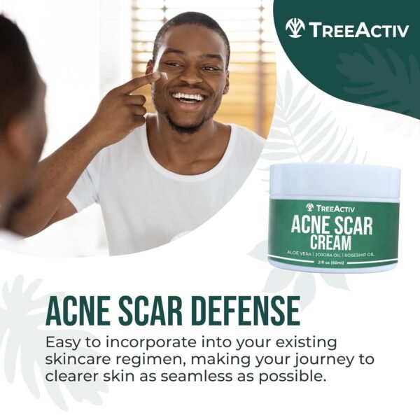 TreeActiv Acne Scar Treatment, 2 fl oz, Acne Scar Cream for Face, Gentle Acne Scars and Dark Spot Remover, Scar Lotion for Stretch Marks and Body Scars, Acne Scar Removal for All Skin Types, 500+ Uses