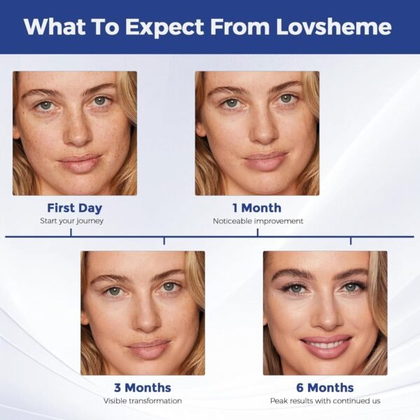 Red Light Therapy for Face, Advanced LED Face Mask Light Therapy, Red Light Therapy Mask - Red, Blue & Infrared Light Therapy for Acne, Wrinkles & Skin Rejuvenation | Enhanced Eye Protection