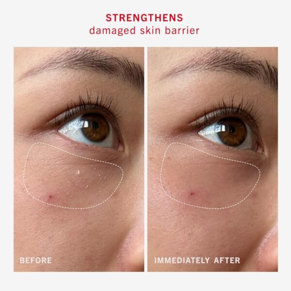 First Aid Beauty - Ultra Repair Rescue Barrier Balm, Deep Hydrating Skin Barrier Mask with 1% Dimethicone, Visible 24-Hour Relief for Dry, Cracked & Chapped Skin, Safe for Sensitive Skin, 2.25 oz