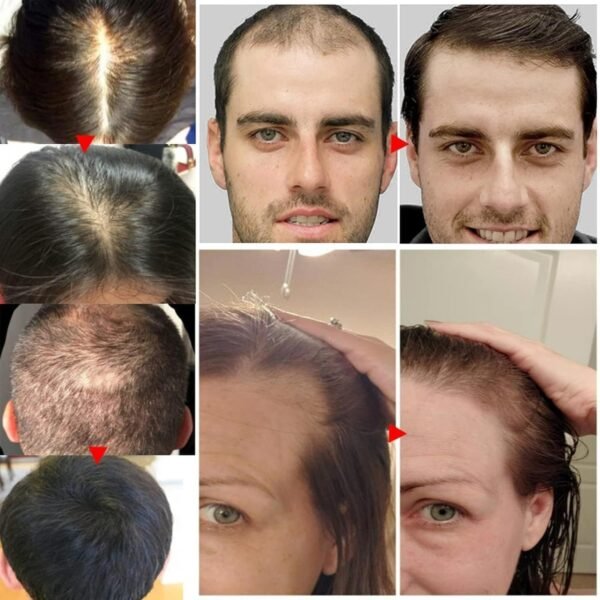 718r8RXeKVL._SL1500_.jpg Rosemary Oil for Hair Growth Organic, 100% Pure Rosemary Essential Oil for Hair Growth, Eyelashs, Eyebrows, Face, Skin Care, Body Massage, Nourishes The Scalp - 60ml / 2.11 oz (2 PCS)