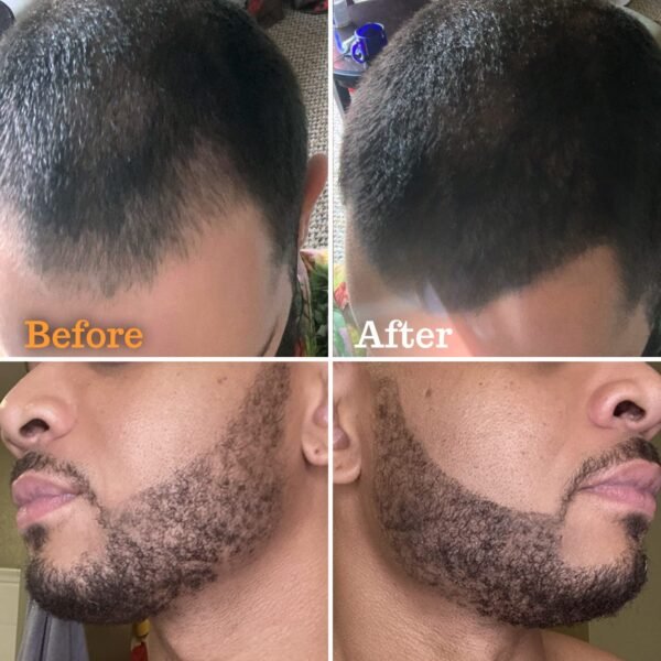 719I26pnFeL._SL1470_.jpg Beard Pen Filler for Men - Barber Styling Grooming Pencil - Waterproof Proof, Sweat Proof, Long Lasting Solution with Natural Finish - Cover Beard and Scalp Patches in Seconds - Black 1 Pack