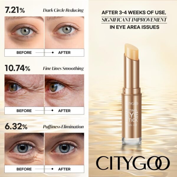 71B8QYOjDOL._SL1500_.jpg CITYGOO Retinol Eye Stick With Collagen, Hyaluronic Acid For Dark Circle, Under Eye Cream Anti Aging, For Puffiness and Bags Reduces Fine Lines (Retinol Eye Stick, 1pcs)