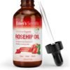 100% Pure Rosehip Oil - 4 OZ - Certified ORGANIC - Cold pressed & unrefined - NON Greasy HIGH absorbency - Use daily - nourishes, hydrates and visibly reduces fine lines, scars, stretch marks and skin