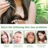 71HVhW-y8QL._SL1500_.jpg Rosemary Oil for Skin Care & Stimulates Hair Growth for Men Women -120ml 100% Pure Rosemary Essential Oil for Eyebrow and Eyelash, Nourishes The Scalp