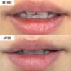71I6RSWsBvL._SL1500_.jpg Hanalei Lip Treatment for Dry, Chapped Lips – Intensive Overnight Moisturizer with Kukui Oil, Shea Butter & Grapeseed Oil – Hydrating Balm for Healing Cracks – Clear Tint, Full-Size 15g – Cruelty-Free