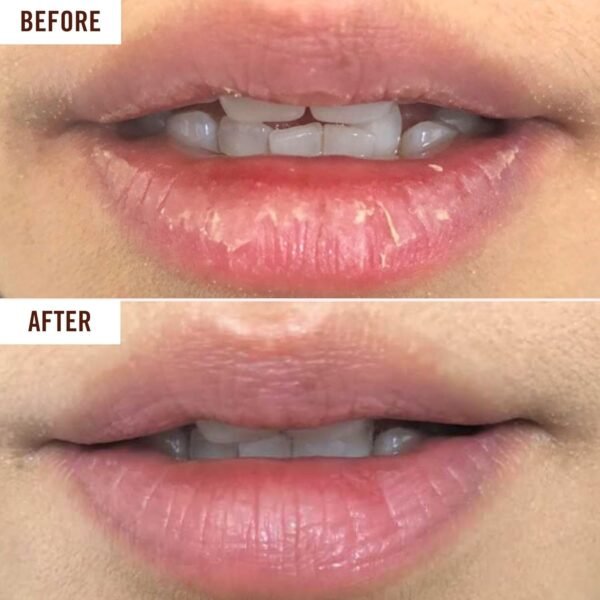71I6RSWsBvL._SL1500_.jpg Hanalei Lip Treatment for Dry, Chapped Lips – Intensive Overnight Moisturizer with Kukui Oil, Shea Butter & Grapeseed Oil – Hydrating Balm for Healing Cracks – Clear Tint, Full-Size 15g – Cruelty-Free