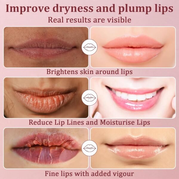 71JwMSdzuNL._SL1500_.jpg 30PCS Moisturizing Lip Mask - Pink Lip Patches for Spa Daily Labial Masks Skincare Hydrating to Reduce Wrinkles Dryness Anti-wrinkle Lightens