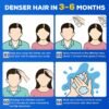 5% Minoxidil for Men and Women，Minoxidil hair Growth Products，Intense Hair Growth Serum，May Promote Faster, Stronger, Thicker Hair Growth to Fight Hair Loss and Thinning Hair（2.82 oz*2）