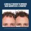Nutrafol Men's Hair Growth Supplements, Clinically Tested for Visibly Thicker Hair and Scalp Coverage, Dermatologist Recommended - 2 Month Supply, 2 Refill Pouches