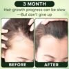 71PRIXbFMHL._SL1500_.jpg Rosemary Oil for Hair Growth Organic, 8.8 floz Essential Oil for Scalp, Eyebrow and Eyelash, Hair Growth Oil Serum for Women Men Hair Strenghtening Treatment With Jojoba Oil & Castor Oil