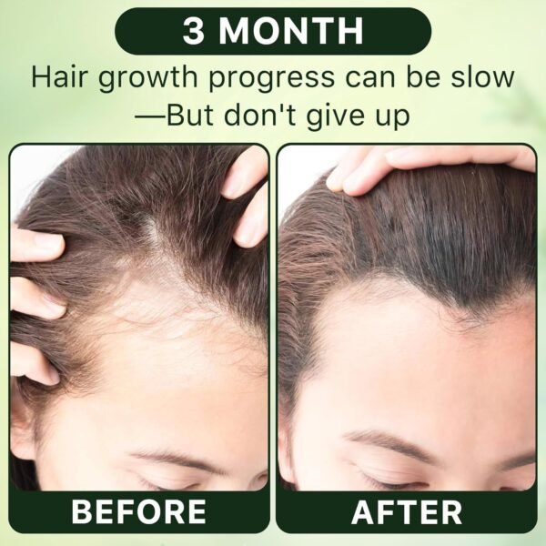 71PRIXbFMHL._SL1500_.jpg Rosemary Oil for Hair Growth Organic, 8.8 floz Essential Oil for Scalp, Eyebrow and Eyelash, Hair Growth Oil Serum for Women Men Hair Strenghtening Treatment With Jojoba Oil & Castor Oil
