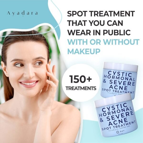71SKPGqk7cL._SL1500_.jpg Warrior One (0.5oz) Acne Spot Treatment with 2% Salicylic Acid, Cystic and Hormonal Acne Cream, Acido Salicilico Acne Spot Treatment for Face, acne Cream for Adults and Teens, 150+ Uses