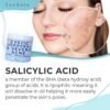 71T9W8Dl6hL._SL1500_.jpg Warrior One (0.5oz) Acne Spot Treatment with 2% Salicylic Acid, Cystic and Hormonal Acne Cream, Acido Salicilico Acne Spot Treatment for Face, acne Cream for Adults and Teens, 150+ Uses