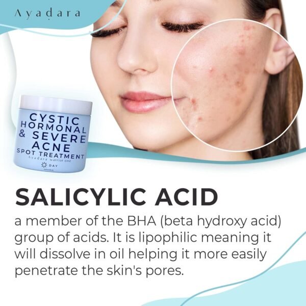 71T9W8Dl6hL._SL1500_.jpg Warrior One (0.5oz) Acne Spot Treatment with 2% Salicylic Acid, Cystic and Hormonal Acne Cream, Acido Salicilico Acne Spot Treatment for Face, acne Cream for Adults and Teens, 150+ Uses