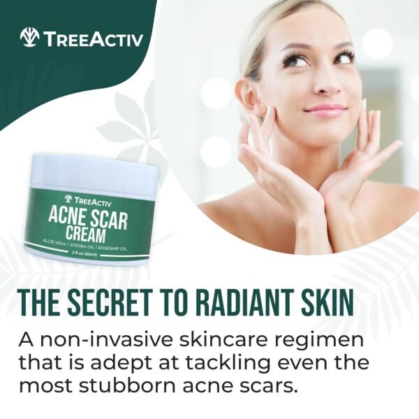 TreeActiv Acne Scar Treatment, 2 fl oz, Acne Scar Cream for Face, Gentle Acne Scars and Dark Spot Remover, Scar Lotion for Stretch Marks and Body Scars, Acne Scar Removal for All Skin Types, 500+ Uses