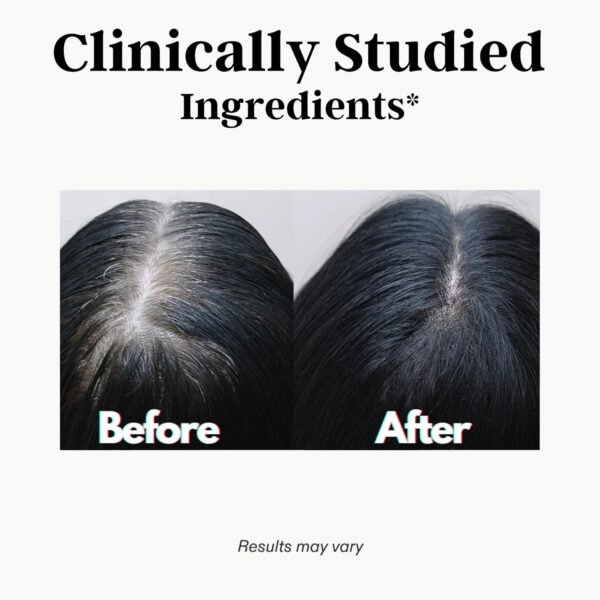 71ZBvpEmiBL._AC_SL1500_.jpg DR VITAMIN SOLUTIONS Gray Hair Rescind with Catalase - Antiaging Hair, Skin and Nails Vitamins, Pantothenic Acid, Folic Acid 400mcg, Biotin 300mcg, Saw Palmetto for Men and Women