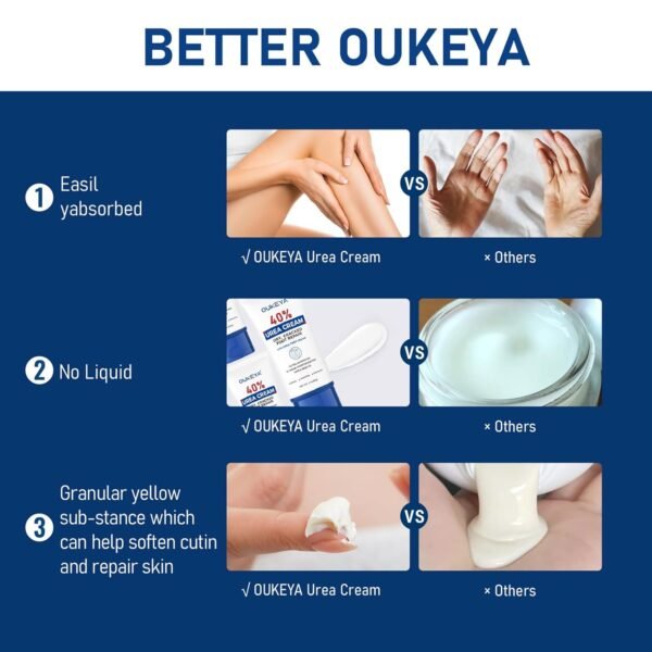 OUKEYA Urea Cream 40 Percent Tube 3 Oz, Urea Foot & Hand Cream for Dry Cracked, 40 per Urea Lotion for Feet Maximum Strength 3 Ounce(Pack of 3)